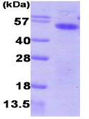 SDS-PAGE - Recombinant Human Aurora A protein (AB86846)