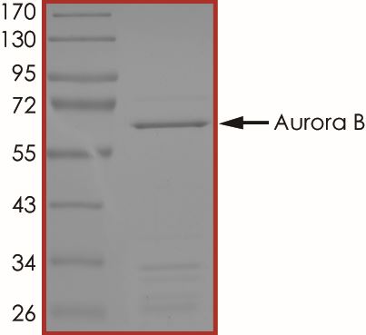 SDS-PAGE - Recombinant human Aurora B protein (AB51435), expandable thumbnail
