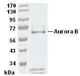 SDS-PAGE - Recombinant human Aurora B protein (AB51435), expandable thumbnail
