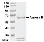 SDS-PAGE - Recombinant human Aurora B protein (AB51435)