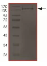 SDS-PAGE - Recombinant Human Axin 1 protein (AB204090)