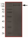 SDS-PAGE - Recombinant Human Axin 1 protein (AB204090)