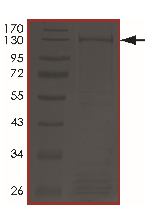 SDS-PAGE - Recombinant Human Axin 2 protein (AB204097)