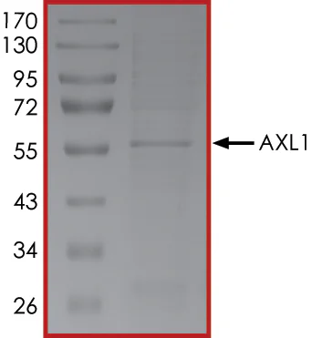 SDS-PAGE - Recombinant human Axl protein (His tag N-Terminus) (AB64298)
