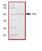 SDS-PAGE - Recombinant human Axl protein (His tag N-Terminus) (AB64298)