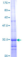 SDS-PAGE - Recombinant Human B2R protein (AB152230), expandable thumbnail