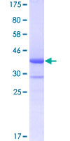 Recombinant Human B4GALT5 protein