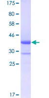 SDS-PAGE - Recombinant Human B4GALT5 protein (GST tag N-Terminus) (AB160437)