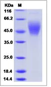 SDS-PAGE - Recombinant human B7-H6 protein (His tag) (AB276723)