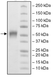 SDS-PAGE - Recombinant Human B7H4 protein (Biotin) (AB198650), expandable thumbnail