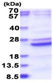 SDS-PAGE - Recombinant Human B9D2 protein (AB183172)