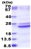 SDS-PAGE - Recombinant Human B9D2 protein (AB183172)