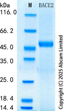 SDS-PAGE - Recombinant Human BACE2 Protein Standard (His tag) (AB316538)