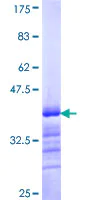 SDS-PAGE - Recombinant Human BACH1.3 protein (AB116862)