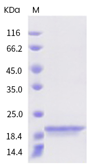 SDS-PAGE - Recombinant Human BAFF/BLyS/TNFSF13B Protein (ECD) (AB319192), expandable thumbnail
