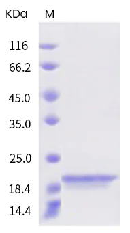 SDS-PAGE - Recombinant Human BAFF/BLyS/TNFSF13B Protein (ECD) (AB319192)