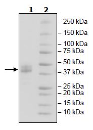 SDS-PAGE - Recombinant Human BAFF-R protein (Fc tag C-Terminus + Avi tag C-Terminus) (AB271388)