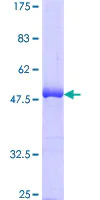SDS-PAGE - Recombinant Human Bak protein (AB114337)