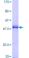 SDS-PAGE - Recombinant Human Bak protein (GST tag N-Terminus) (AB114337)