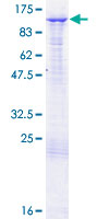 SDS-PAGE - Recombinant Human BAP1 protein (AB152849), expandable thumbnail