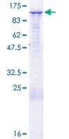 SDS-PAGE - Recombinant Human BAP1 protein (GST tag N-Terminus) (AB152849)