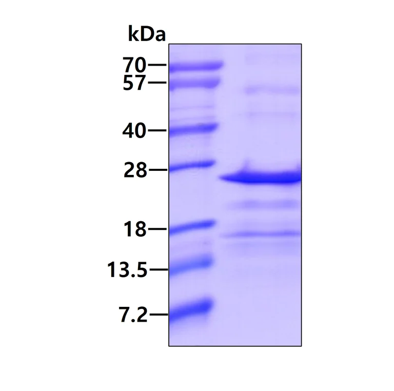 SDS-PAGE - Recombinant Human BAP18 protein (AB131691)