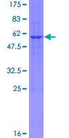 SDS-PAGE - Recombinant Human BAP31 protein (AB132144)
