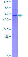 SDS-PAGE - Recombinant Human BAP31 protein (GST tag N-Terminus) (AB132144)