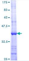SDS-PAGE - Recombinant Human BARD1 protein (AB114640)