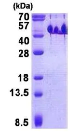 SDS-PAGE - Recombinant Human BASP1 protein (His tag N-Terminus) (AB140056)