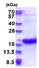 SDS-PAGE - Recombinant Human BATF3 protein (AB177712)