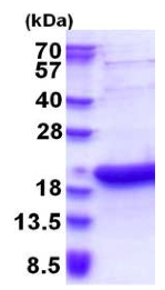 SDS-PAGE - Recombinant Human BATF3 protein (His tag N-Terminus) (AB177712)