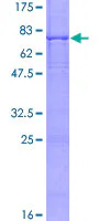 SDS-PAGE - Recombinant Human BBS1 protein (AB157954)
