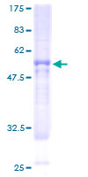 Recombinant Human BBS9 protein
