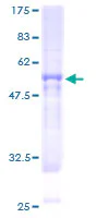 SDS-PAGE - Recombinant Human BBS9 protein (GST tag N-Terminus) (AB162122)