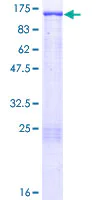 SDS-PAGE - Recombinant Human BCAR1 protein (AB132142)