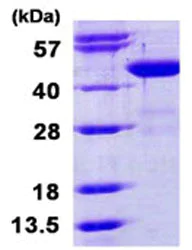 SDS-PAGE - Recombinant Human BCAT1 protein (His tag N-Terminus) (AB124556)