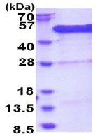 Recombinant Human BCCIP protein - BSA and Azide free