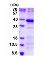 SDS-PAGE - Recombinant Human BCDIN3D protein (His tag N-Terminus) (AB134588)
