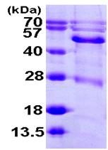 SDS-PAGE - Recombinant Human BCKDHA protein (AB104900)