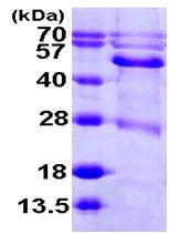 SDS-PAGE - Recombinant Human BCKDHA protein (His tag N-Terminus) (AB104900)