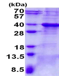 SDS-PAGE - Recombinant Human Bcl 7A protein (His tag N-Terminus) (AB139229)