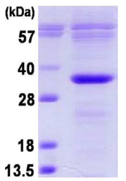 SDS-PAGE - Recombinant Human Bcl10 protein (His tag N-Terminus) (AB124575)