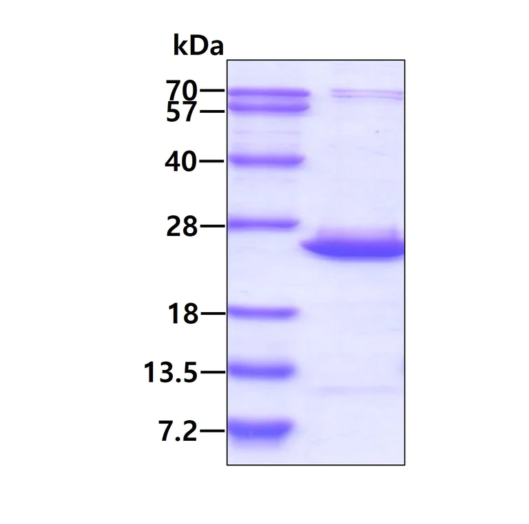 SDS-PAGE - Recombinant Human BCL2L10 protein (His tag N-Terminus) (AB139228)
