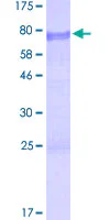 SDS-PAGE - Recombinant Human Bcl3 protein (GST tag N-Terminus) (AB152226)