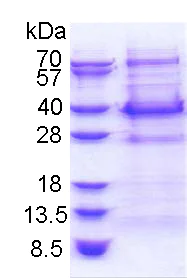 SDS-PAGE - Recombinant Human BCL7C protein (AB174409)