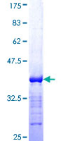 Recombinant Human BCL9 protein