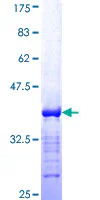 SDS-PAGE - Recombinant Human BCL9 protein (GST tag N-Terminus) (AB157959)