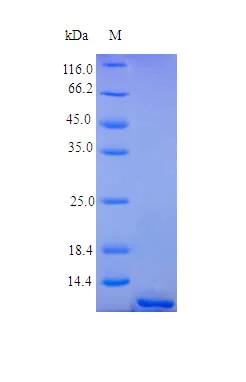 SDS-PAGE - Recombinant human BCMA protein (Active) (AB243796)