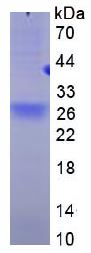 SDS-PAGE - Recombinant Human BCMA protein (His tag) (AB270592), expandable thumbnail
